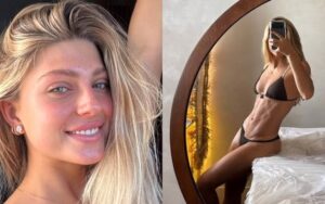 Filha de Eduardo Moscovis exibe resultado de procedimentos estéticos em clique ousado