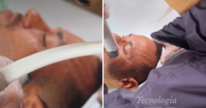 Neymar investe em tecnologia de radiofrequência para cuidar da pele