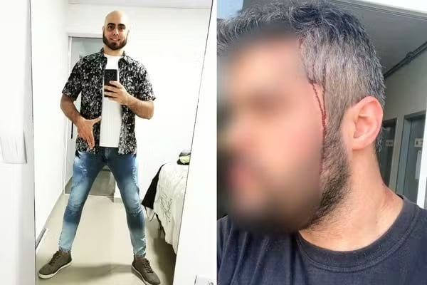 Sobrinho de Bolsonaro terá chance de novo julgamento: justiça de SP anula absolvição por tentativa de homicídio