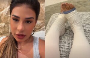 Simone Mendes se submete a cirurgia estética e abre o coração sobre insegurança com o corpo