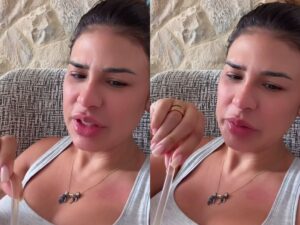 Simone Mendes mostra recuperação pós-cirurgia e brinca sobre retirada de dreno