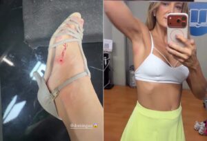 Ticiane Pinheiro mostra ferimentos nos ensaios e brinca: ‘Dando meu sangue’