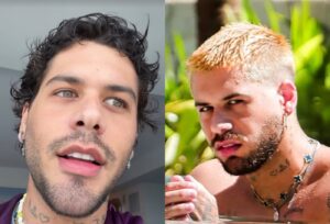 Zé Felipe rebate boatos sobre plástica no rosto e revela verdade: emagrecer 5 kg